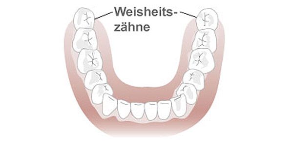 Zahnentfernung / -freilegung